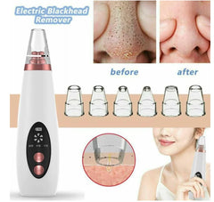 Pore Vacuum Blackhead Remover